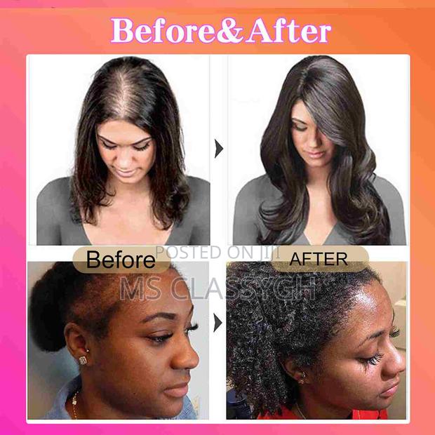 Batana Oil Hair Growth Natural Oil Hair Loss Anti-Breakage · Photo 3