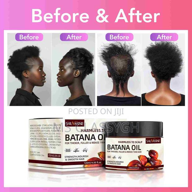 Batana Oil Hair Growth Natural Oil Hair Loss Anti-Breakage · Photo 4