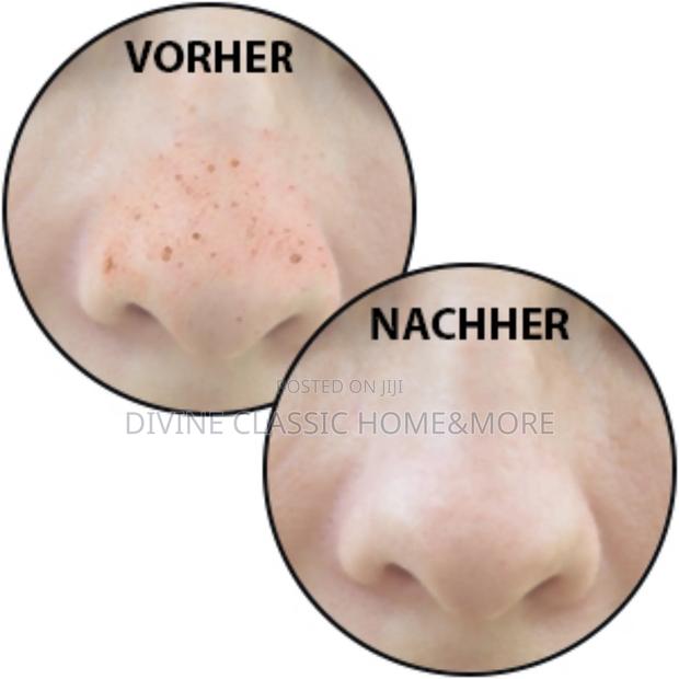 Proficare Black Head Remover · Photo 4