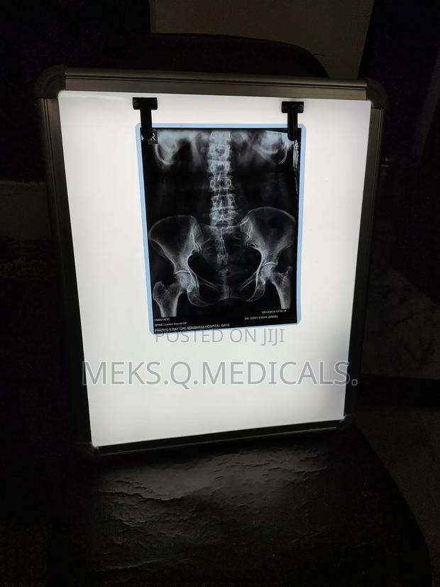 X- Ray View Box Single · Photo 2