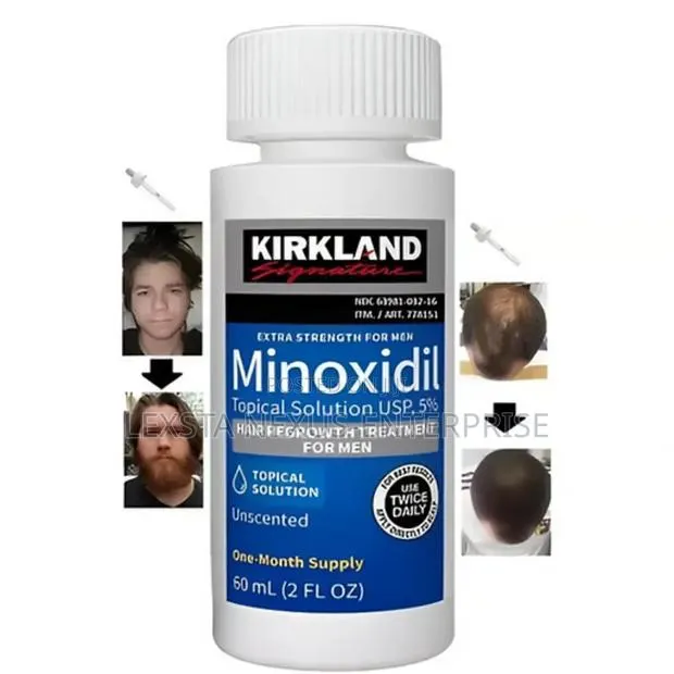 Kirkland Minoxidil Hair Growth · Photo 1