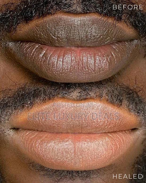 Permanent Lips Tattoo · Photo 3
