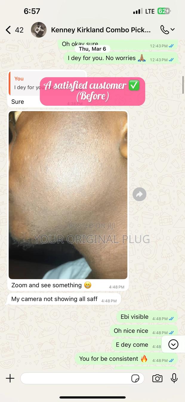 Kirkland Minoxidil + Derma Roller (Beard Growth Baldness) · Photo 5