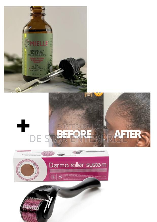Mielle Rosemary Oil + Derma Roller System for Edges · Photo 1
