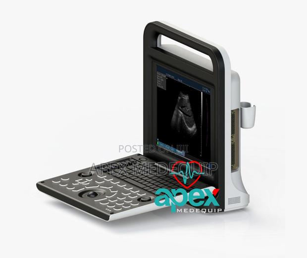 Brandnew Sonotec Dp-30 Digital Ultrasound System + Trolley · Photo 3