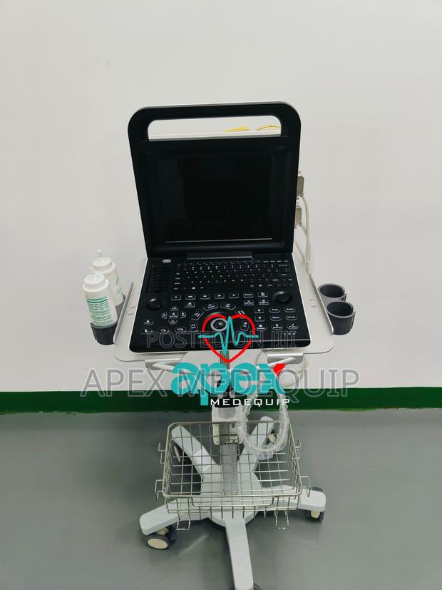 Brandnew Sonotec Dp-30 Digital Ultrasound System + Trolley · Photo 2