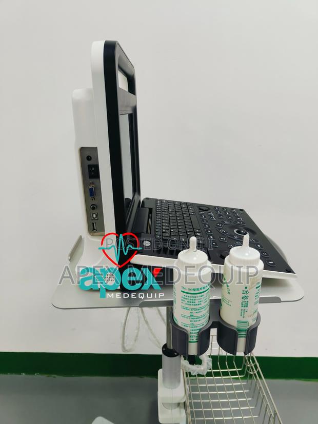 Brandnew Sonotec Dp-30 Digital Ultrasound System + Trolley · Photo 1