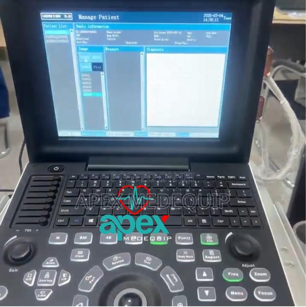 Portable Digital Ultrasound Sonotec Dp30 + 1 Probe + Trolley · Photo 2
