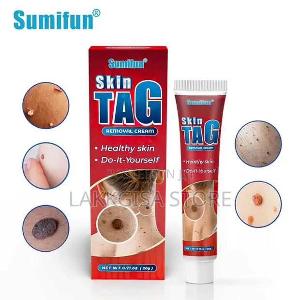 Skin Tag Remover · Photo 1