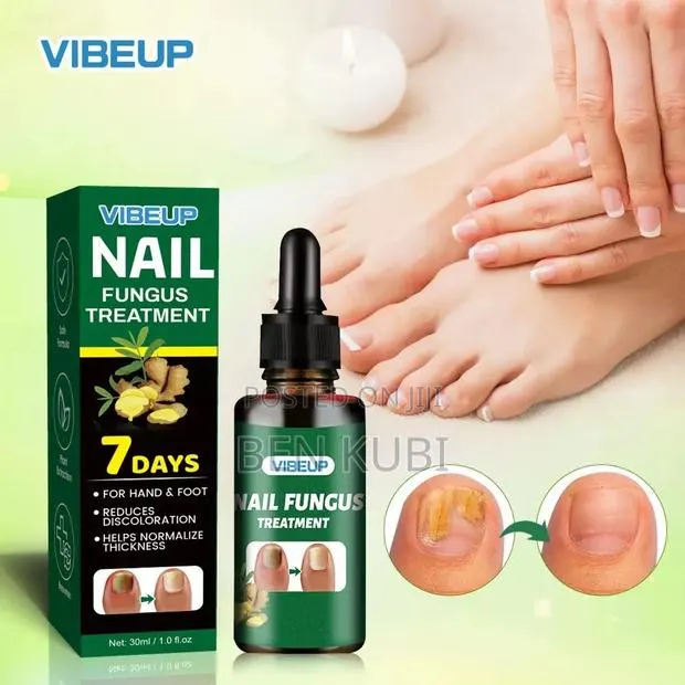 Nail Fungus Treatment · Photo 1