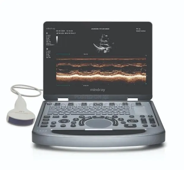 Mindray Dp10 Ultrasound Scan Machine · Photo 1