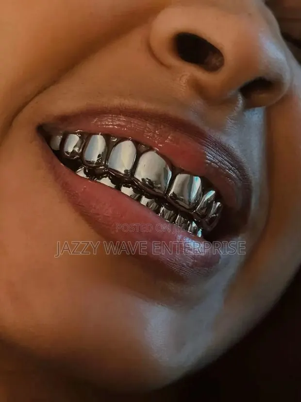 Teeth Grill · Photo 1