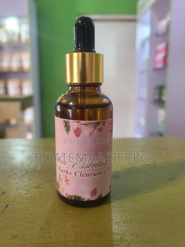 Stretch Marks Oil · Photo 2