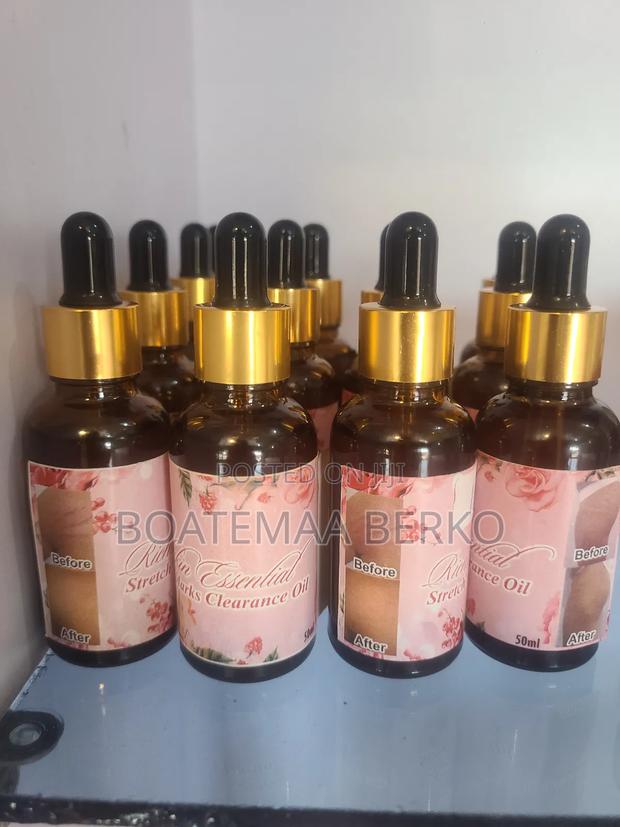 Stretch Marks Oil · Photo 1