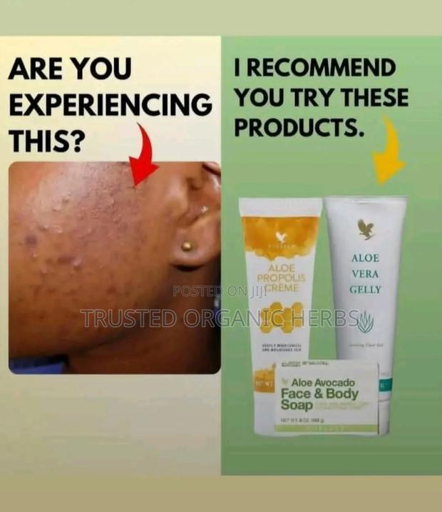 Best Skincare Combo - Acne Solution · Photo 1