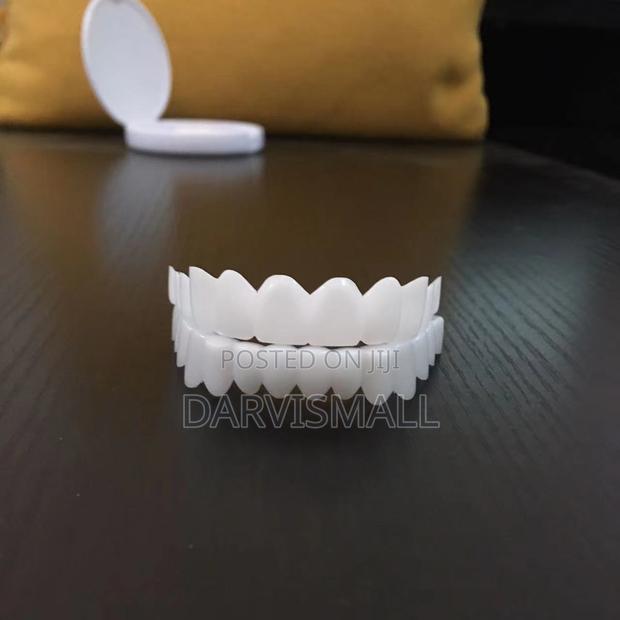 Fake Veneers Teeth · Photo 3