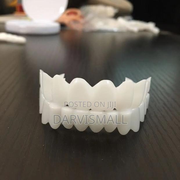 Fake Veneers Teeth · Photo 2