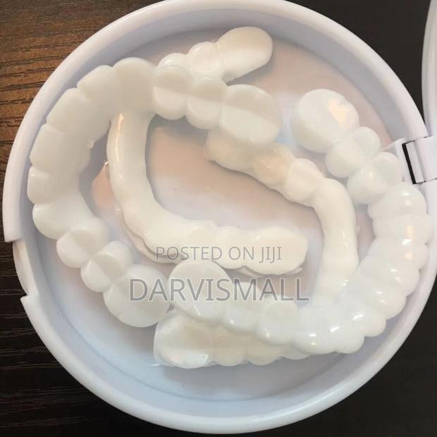 Fake Veneers Teeth · Photo 4
