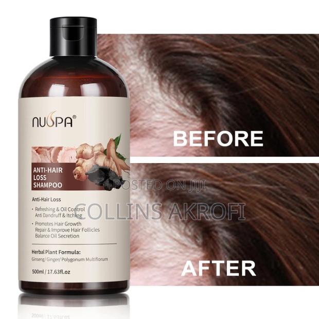 Anti Hair Loss, Haircare Set. · Photo 3