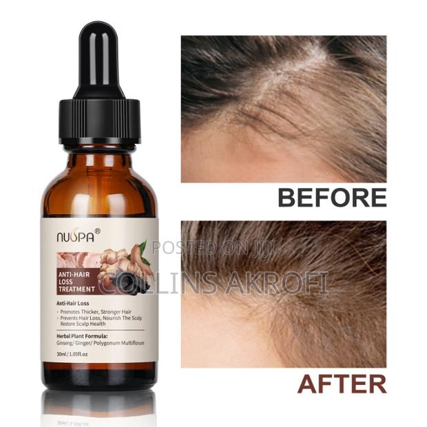 Anti Hair Loss, Haircare Set. · Photo 4
