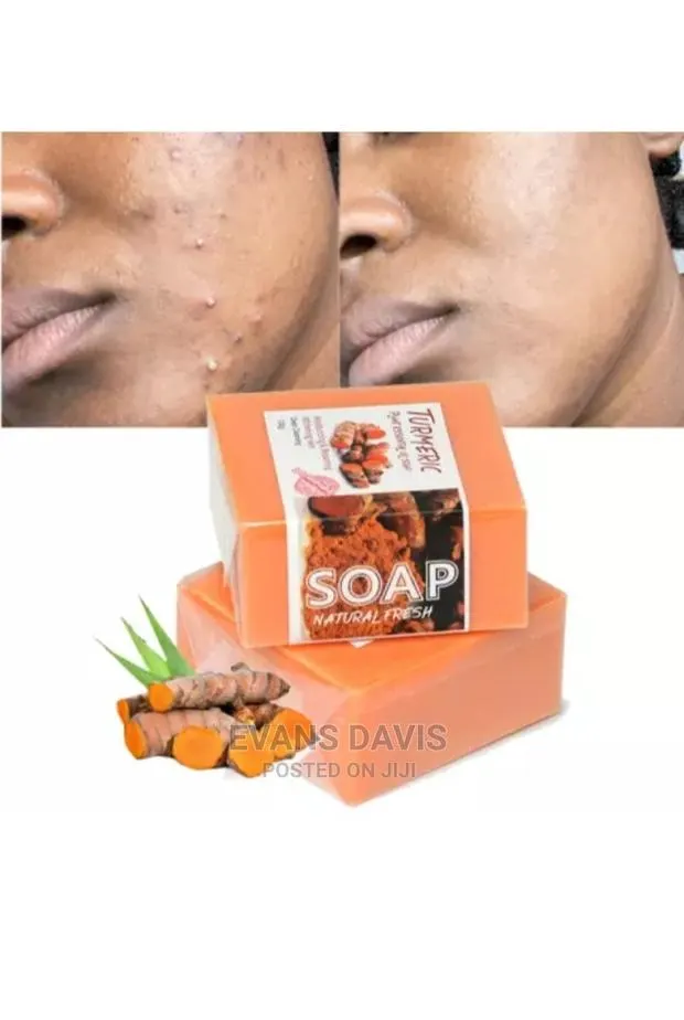Tumeric Acne, Sunburns and Dark Spot Remover Soap · Photo 1