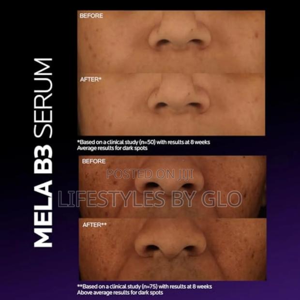 Mela B3 Dark Spot Serum With Melasyl + Niacinamide Serum · Photo 2
