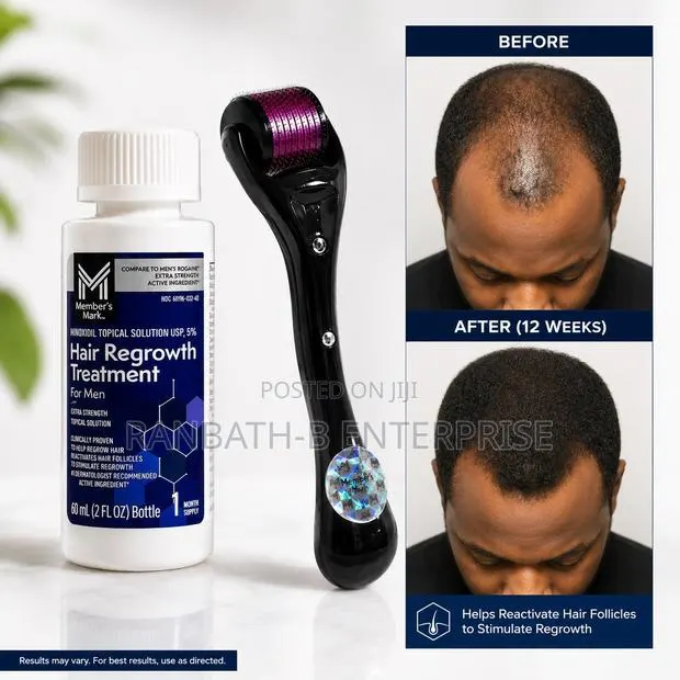 Member’s Mark Minoxidil 5% + Derma Roller Combo | Fuller- Hair Routine · Photo 1