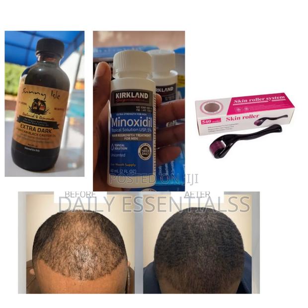 Full Hair Regrowth Combo Pack · Photo 1
