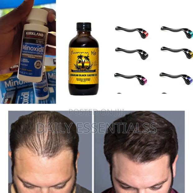 Hair Rescue Bundle – Fast Results · Photo 1