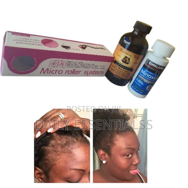 Kirkland Hair Boost + Natural Oil Therapy · Photo 1