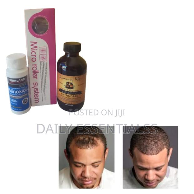 Men Women Hair Growth Kit · Photo 1