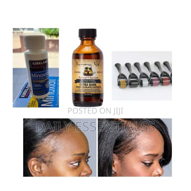 Advanced Hair Regrowth Combo (Best Seller) · Photo 1