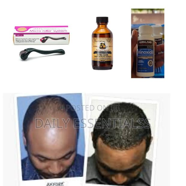 Power Growth Pack – Edges, Crown Beards · Photo 1