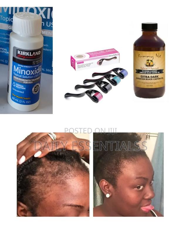Hair Growth Essentials Kit · Photo 1