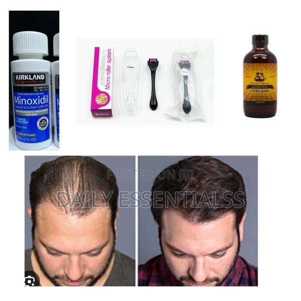 Balding? Thinning? This Set Is for You! · Photo 1