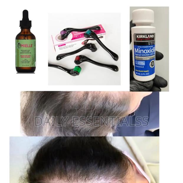 Kirkland X Mielle X Derma Roller Growth Combo · Photo 1