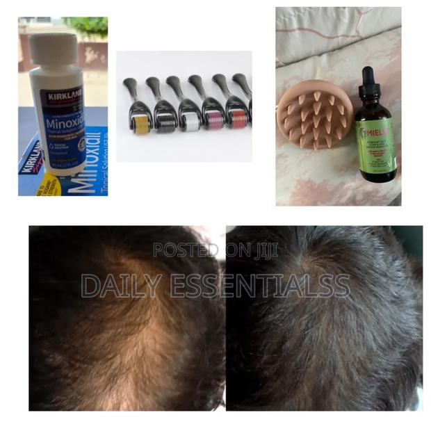 Full Beard Hair Kit: Kirkland, Mielle Derma Roller · Photo 1