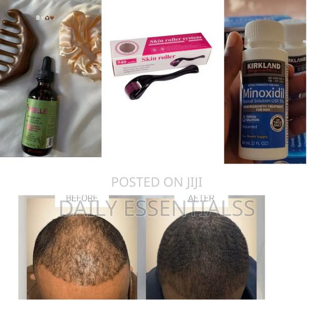Kirkland Mielle Growth Set With Derma Roller · Photo 1