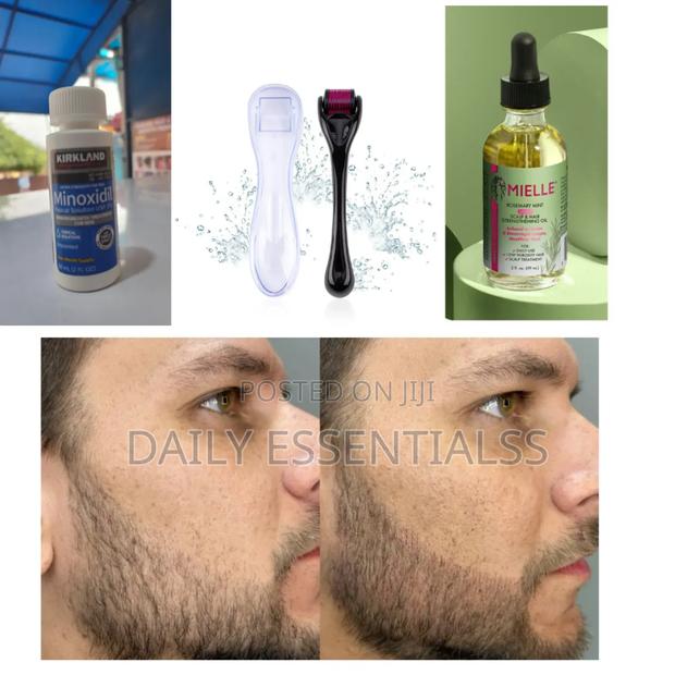 The Power Growth Kit – Kirkland, Mielle Roller Combo · Photo 1