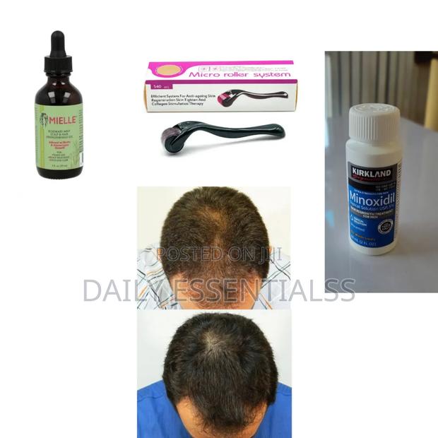 3-Step Hair Beard Growth – Mielle, Kirkland Roller · Photo 1