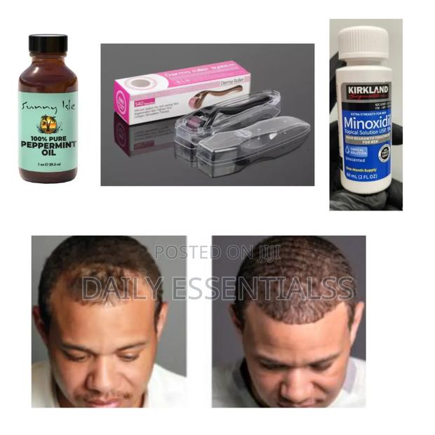 Kirkland, Peppermint Derma Roller Combo · Photo 1