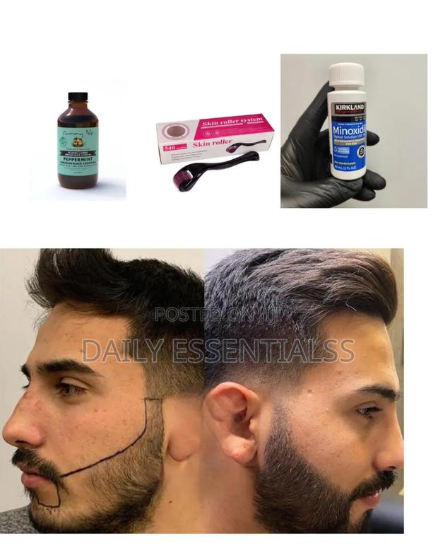 Kirkland Minoxidil, Derma Roller Peppermint Power Pack · Photo 1