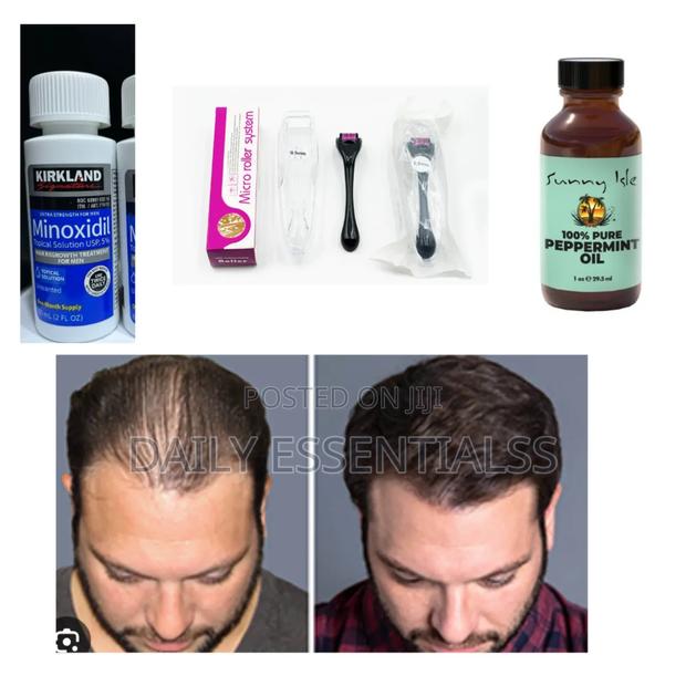 Kirkland, Peppermint Derma Roller – Growth Game Strong · Photo 1