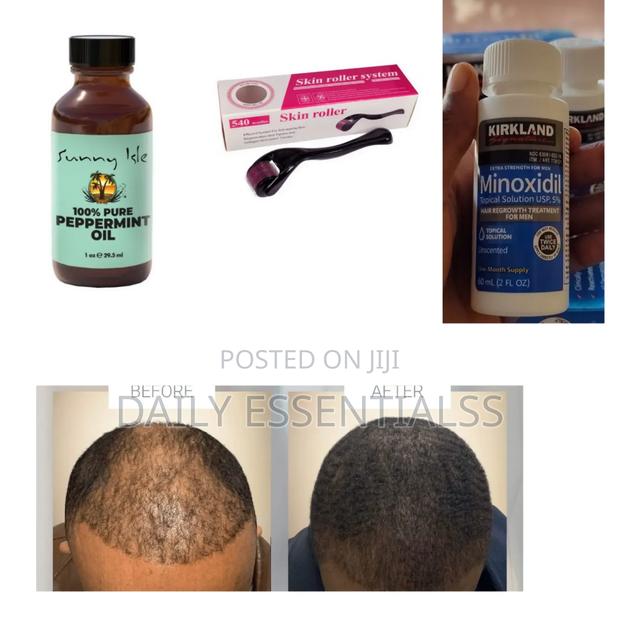 Kirkland, Peppermint Oil Derma Roller Growth Set · Photo 1