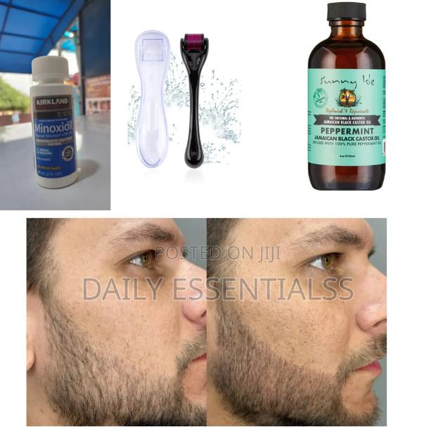 Derma Roller, Kirkland Peppermint Oil Hair Boost Trio · Photo 1