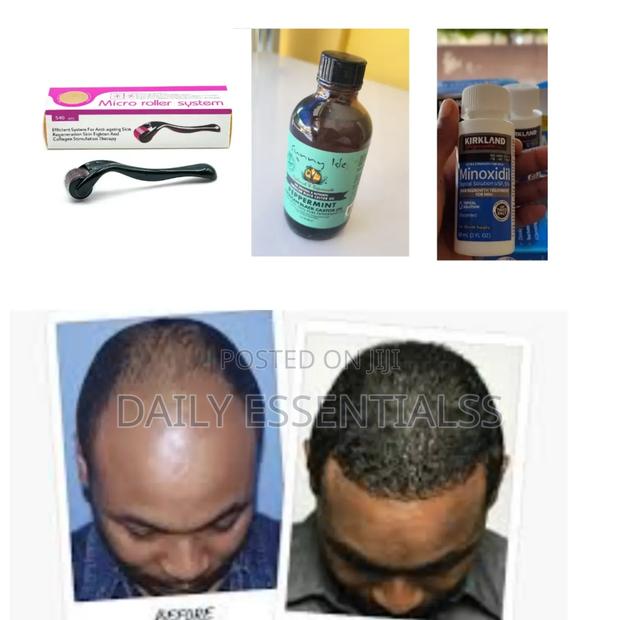 Kirkland Minoxidil,Derma Roller Peppermint Oil Combo Pack · Photo 1