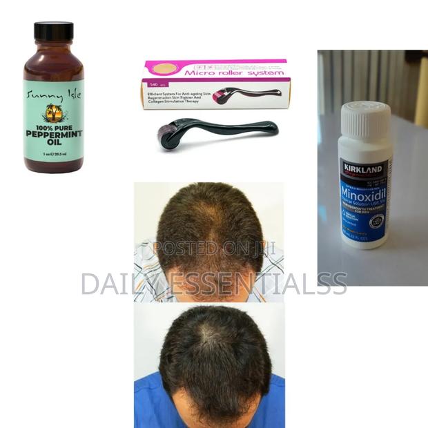 Kirkland+ Derma Roller +Peppermint Oil Hair Beard Booster · Photo 1