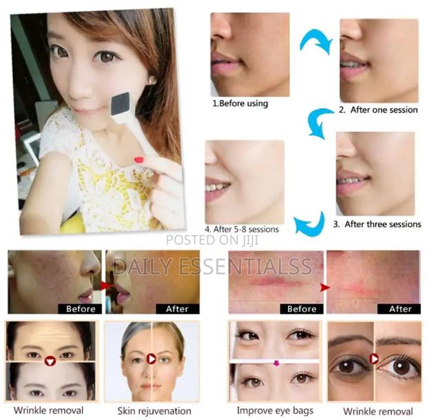 Micro-Pin Perfection – Derma Stamp Skincare Tool · Photo 2