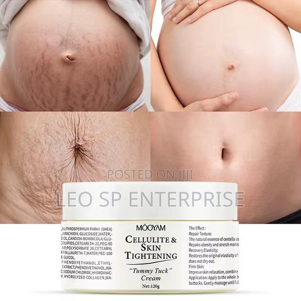 Mooyam Stretch Marks and After Pregnancy Cream · Photo 2