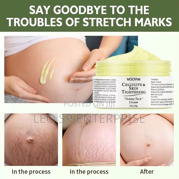 Mooyam Stretch Marks and After Pregnancy Cream · Photo 5